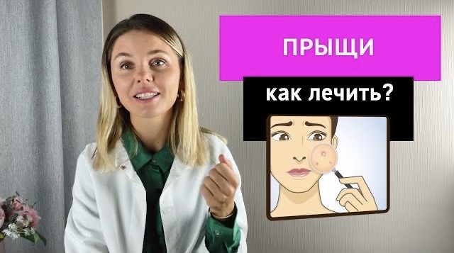 Прыщи: как лечить?