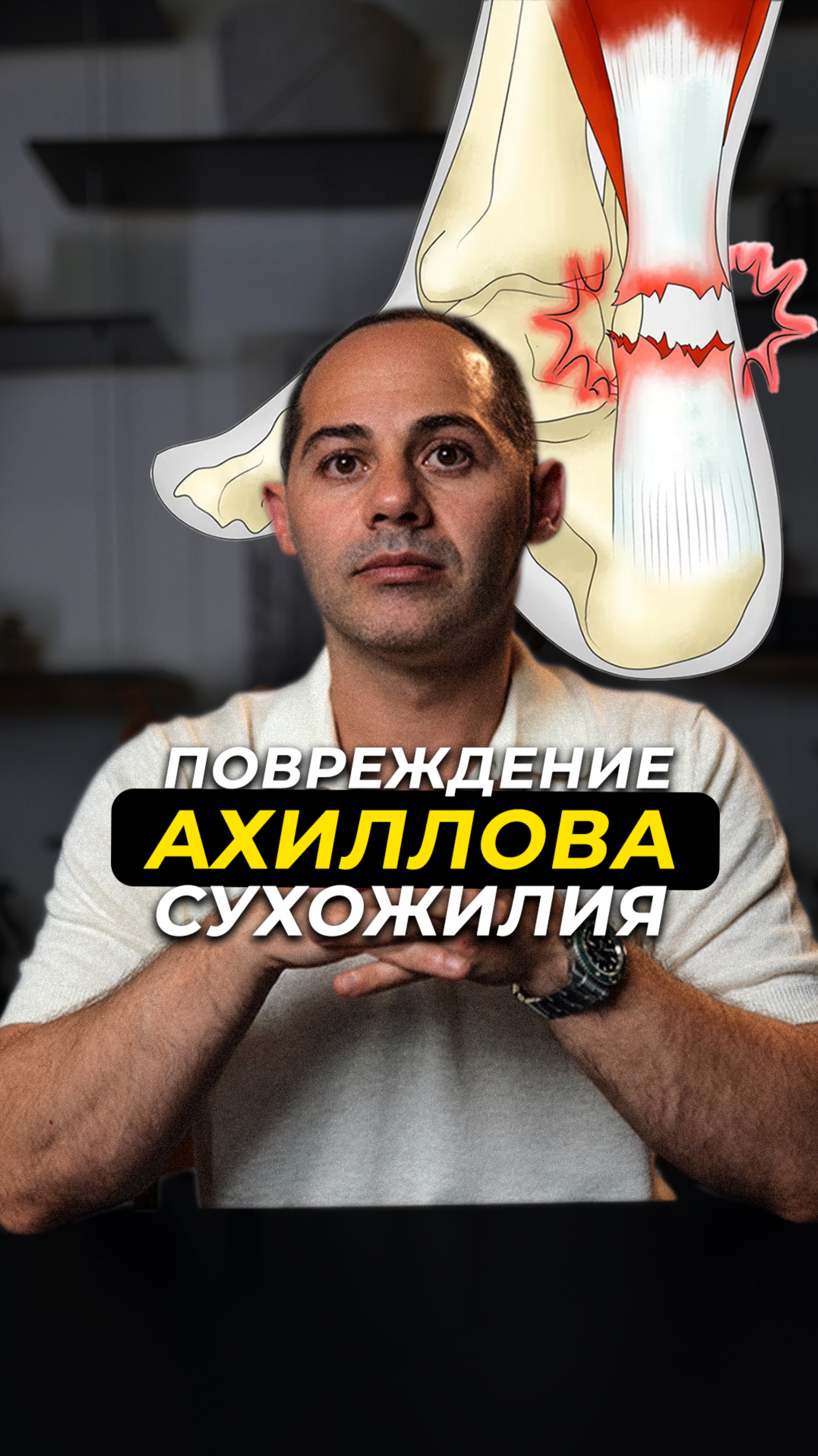 ПОВРЕЖДЕНИЕ АХХИЛОВОГО СУХОЖИЛИЯ
