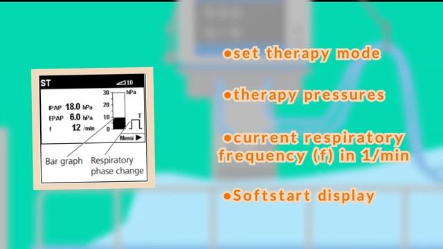 Tutorial: How To Set Up And Operate Artificial Respirator VENTIMOTION 2