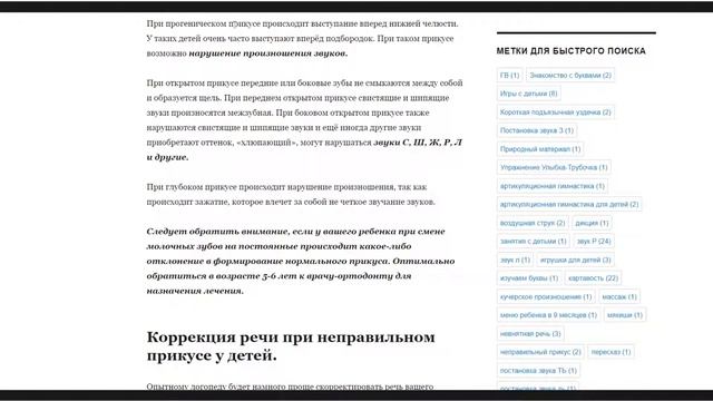 Влияние прикуса у детей на произношение  Влияние неправильного прикуса на звукопроизношение у детей