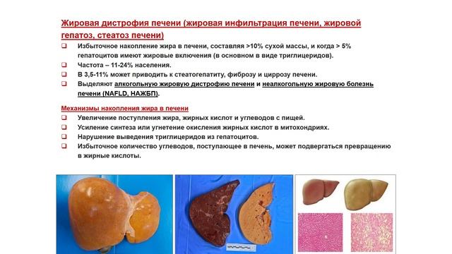 Ультразвуковая диагностика (УЗИ). Доктор Иогансен. Выпуск 9. Диффузные изменения печени. Часть 1.