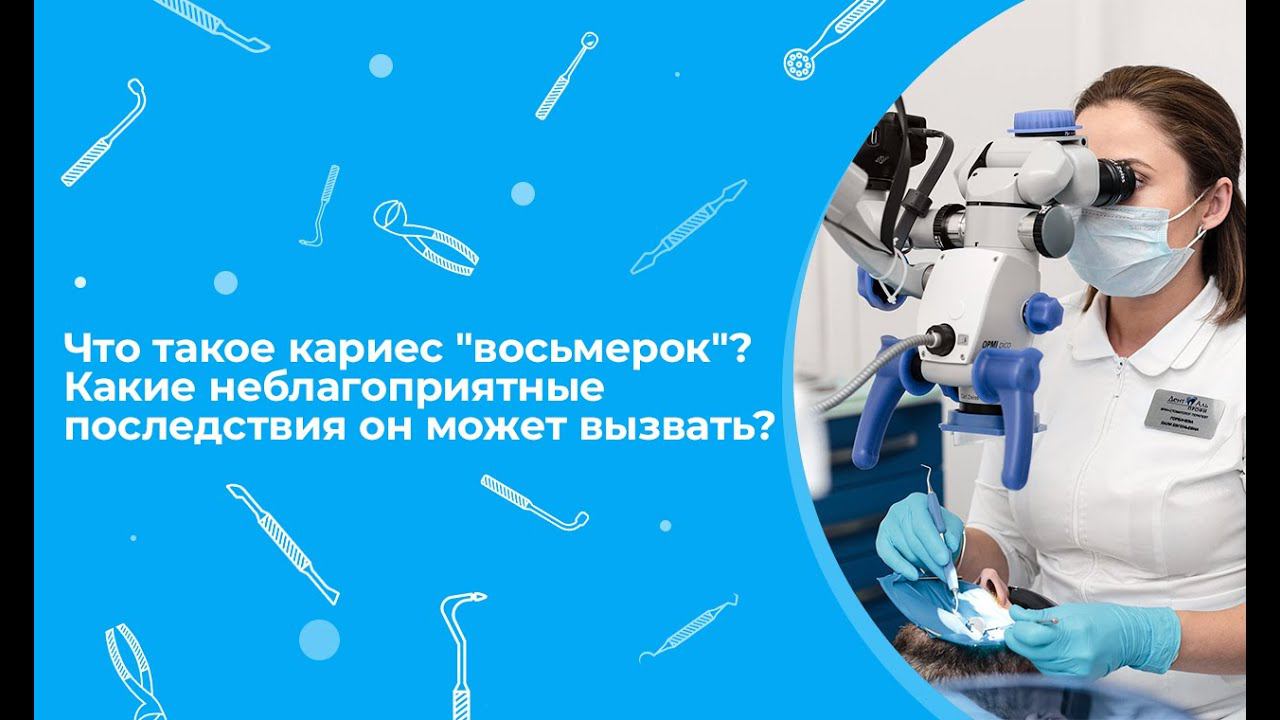 Что такое кариес "восьмерок"? Какие неблагоприятные последствия он может вызвать?