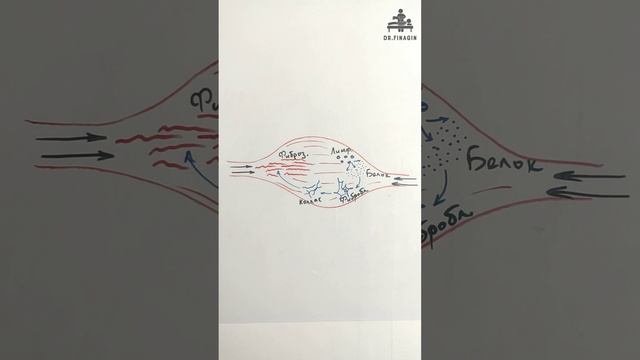 Гиподинамия фиброз тканей.  Финагин Федор Алексеевич