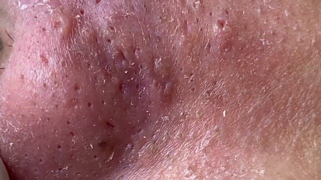 Satisfying Relaxing Best Video with Win Spa 118