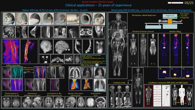 MRI at 0.5 Tesla