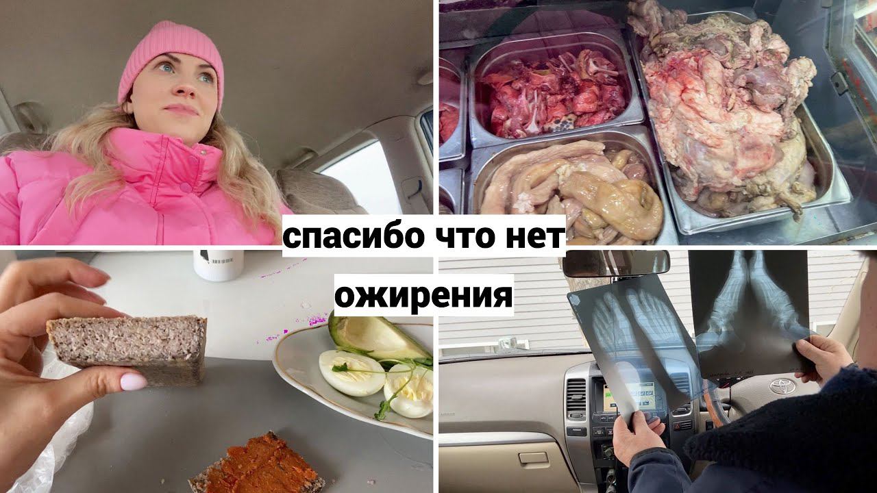 Vlog#820 Сделала Рентген Шеи и НОГ/Была у Подиатра