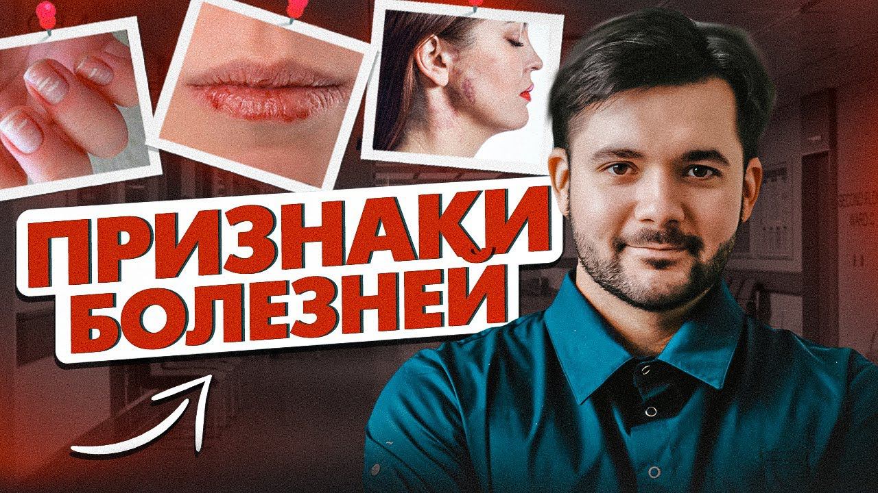 БЫСТРАЯ ДИАГНОСТИКА ЗАБОЛЕВАНИЙ ПО ВНЕШНИМ ПРИЗНАКАМ! Как избежать болезней