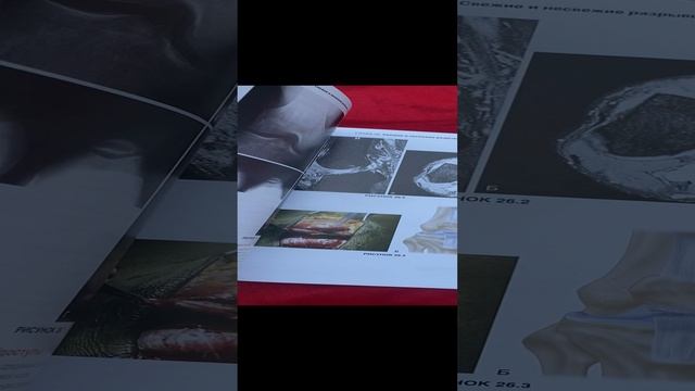 Хирургия колена. Оперативная техника