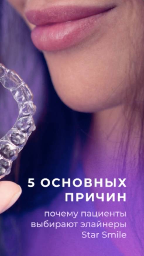 5 причин, почему пациенты выбирают элайнеры Star Smile