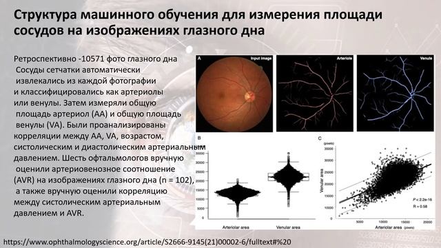 новости офтальмологии