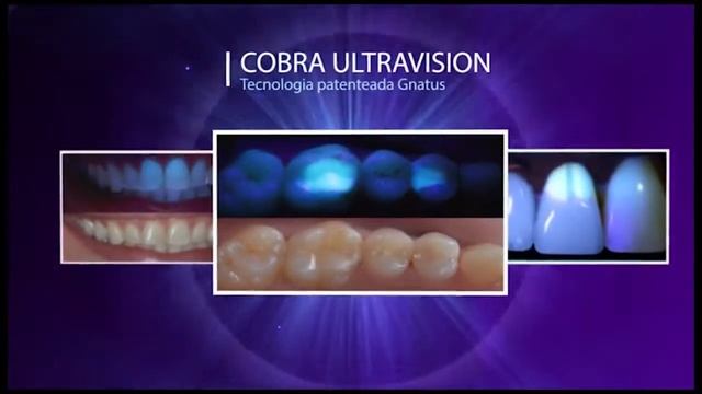 COBRA PB LED - турбинный наконечник | Gnatus (Бразилия)