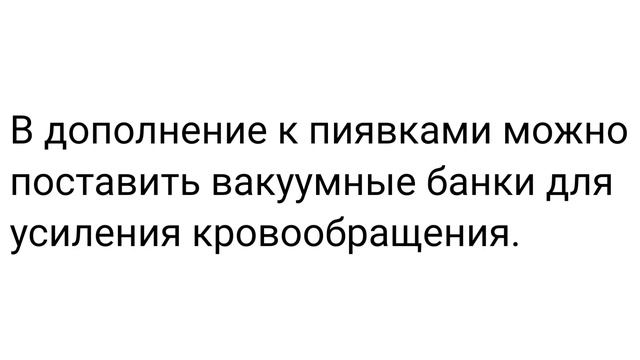 Гирудотерапия. Первичная постановка. Куда ставить пиявки.