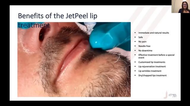 LIVE WEBINAR: CUIDADO DE LABIOS CON JETPEEL