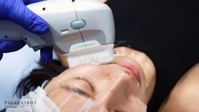 HIFU Skin Tightening | Real People, True Results