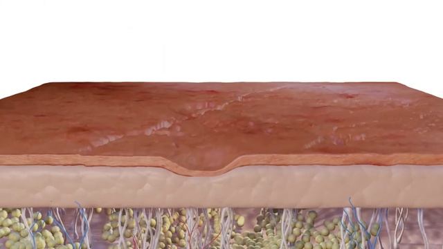 Фракционная технология 3DEEP Intensif