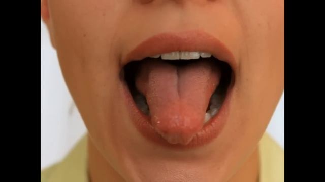 Артикуляционная Гимнастика - Чашка Блюдце Тортик