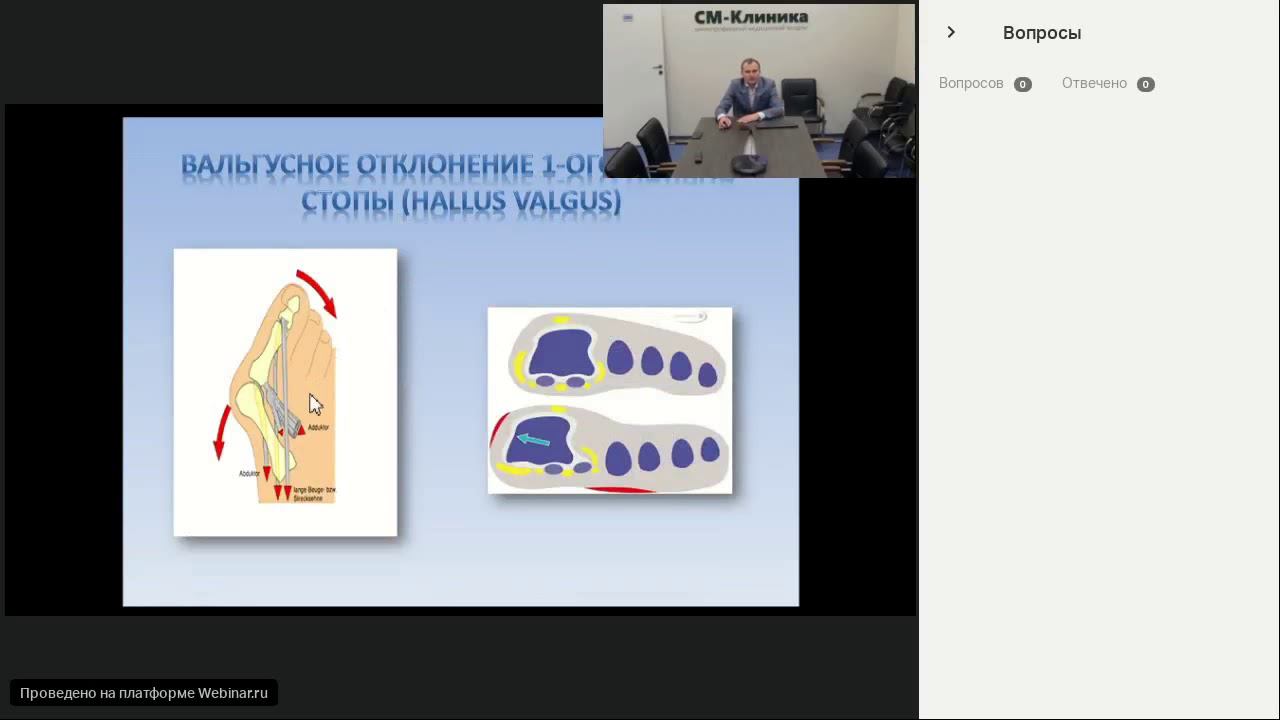 Запись вебинара «Хирургия стопы» - Исаев О.Н. (05.06.2018)