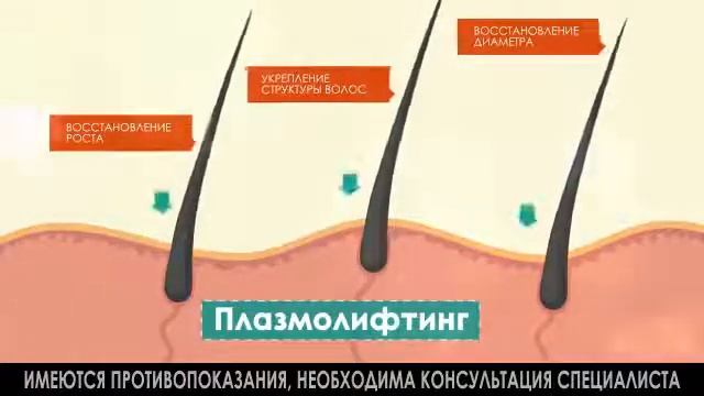 Плазмолифтинг для волос