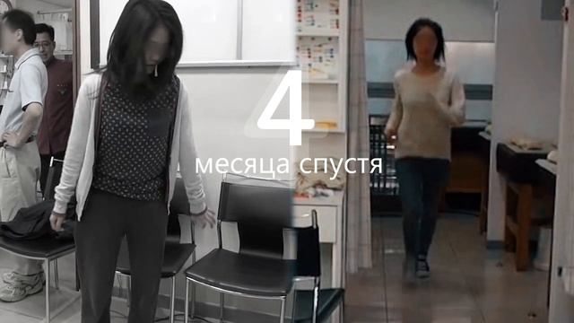 Спастическая кривошея и обобщенная дистония. Лечение до и после