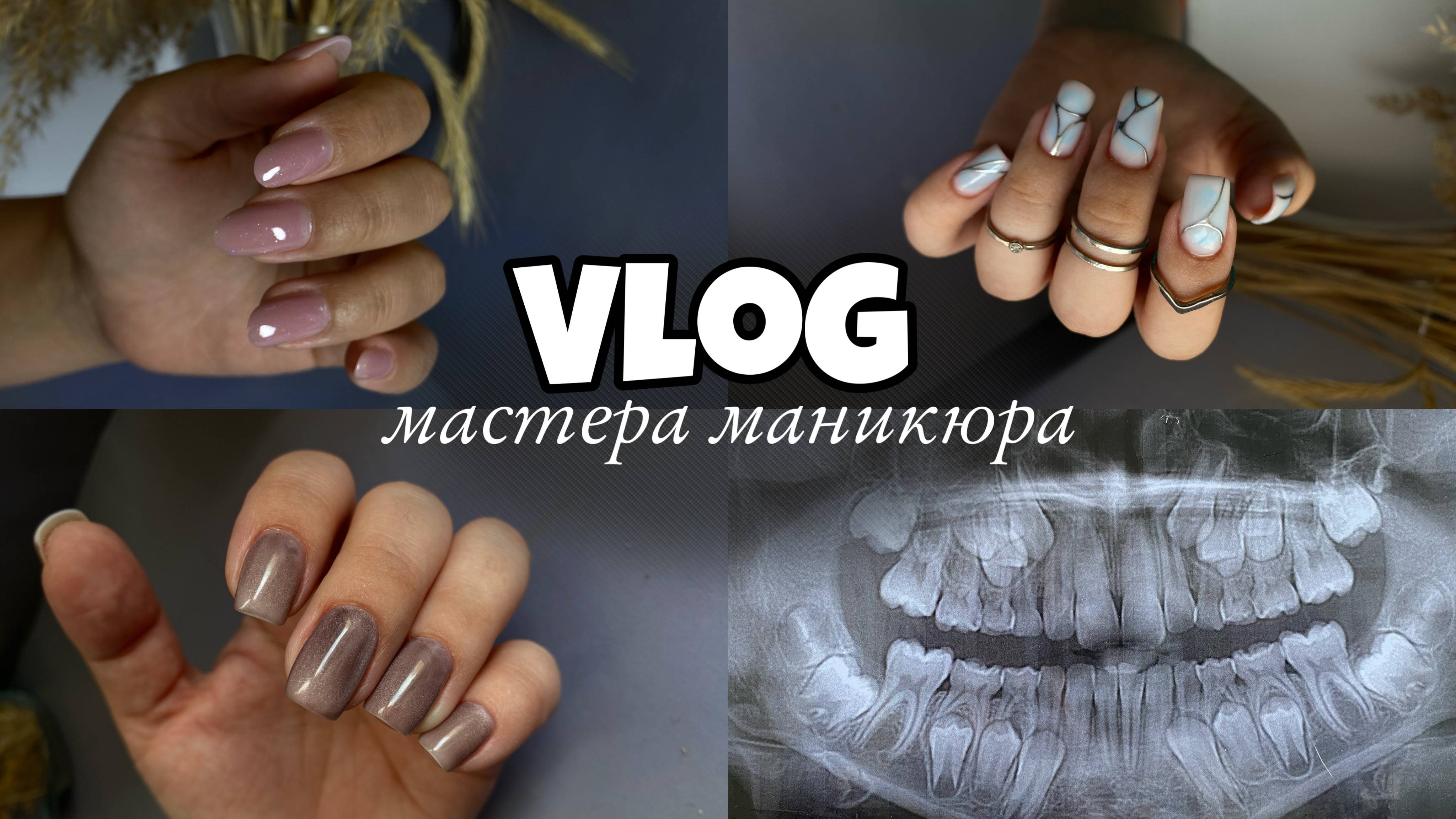 Nail Vlog 58 Будни мастера/ Ходили к ортодонту/Много работ