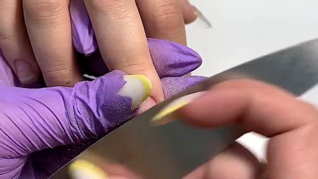 Трындец ногтям из-за климата Полное отслоение от ложа  Пришлось переехать Наращивание