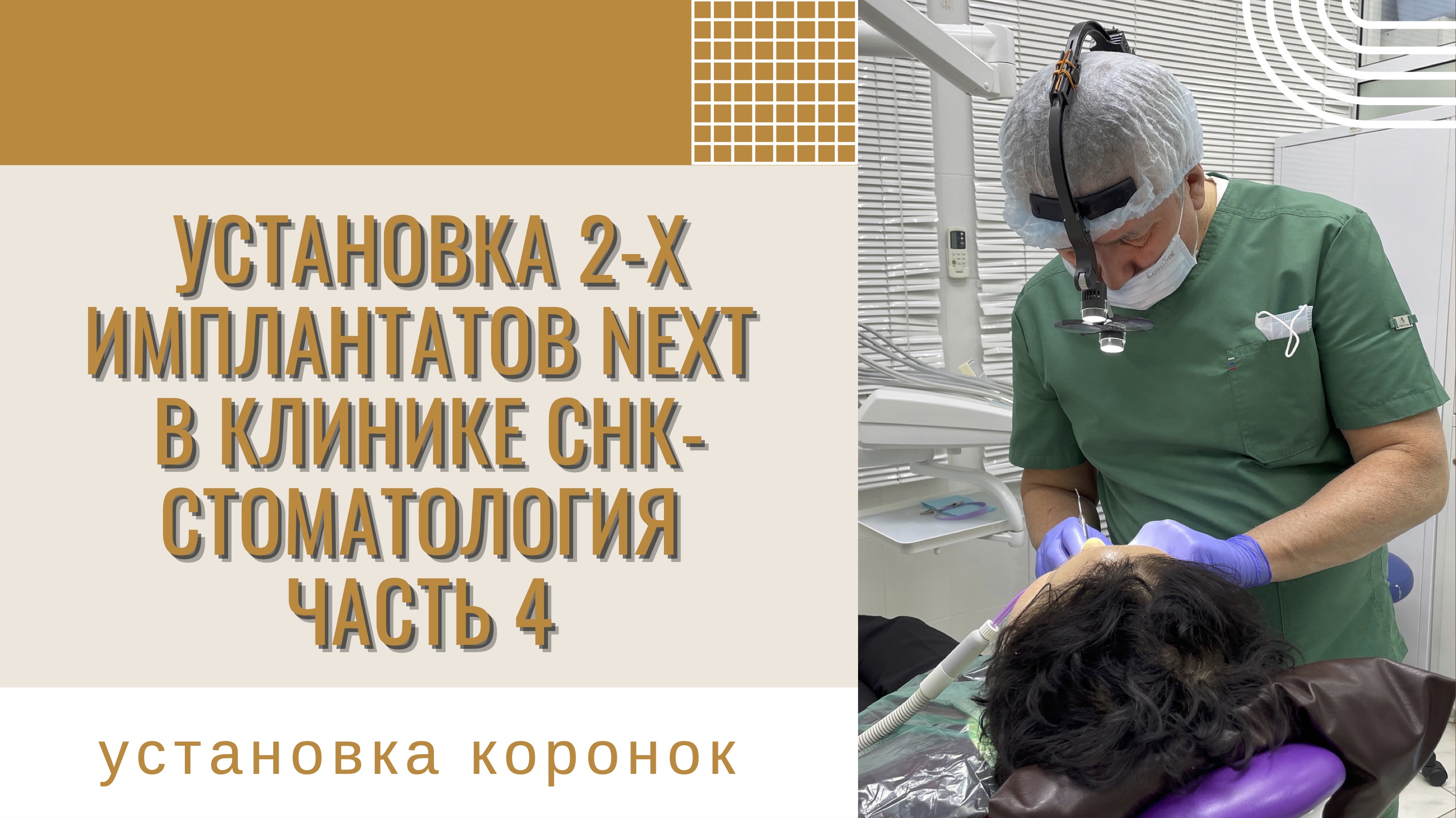 Установка 2-х имплантов в клинике СНК-Стоматология. Часть 4. Ортопедический этап - установка коронок