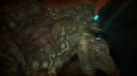 The Callisto Protocol Official Contagion Bundle Trailer #gameplaydecade