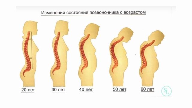 ПЕРЕЛОМ ПОЗВОНОЧНИКА БЕЗ ТРАВМЫ.ПОЧЕМУ НЕ ЗАЖИВАЕТ?