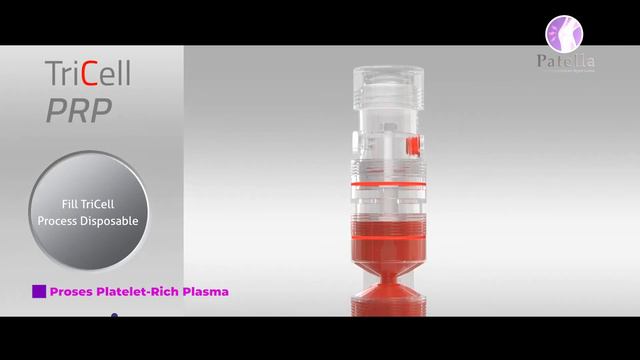 Platelet-Rich Plasma (PRP) Berproses Ke Arah Lebih Baik 
