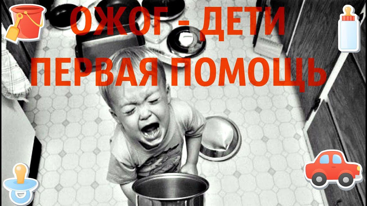 ОЖОГ- ДЕТИ! ОЧЕНЬ ВАЖНОЕ ВИДЕО!