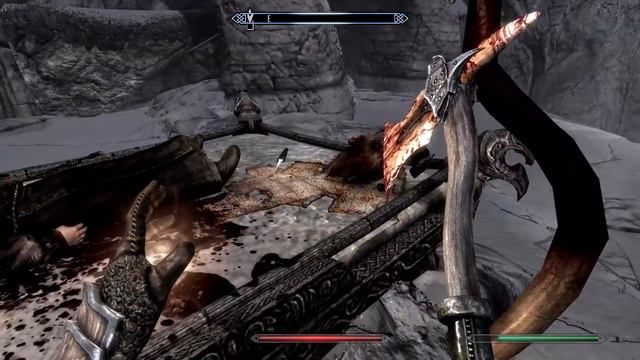 Inigo doesn't like me