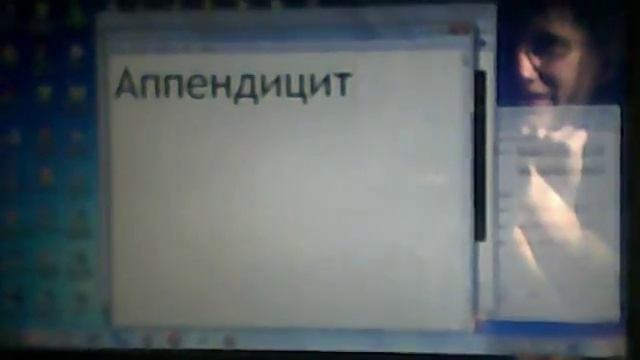 как вырезать аппендицит (видео-урок)