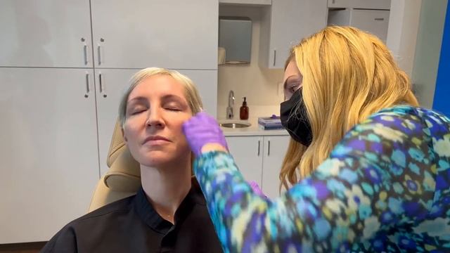 Sculptra treatment with BEFORE & AFTER results - Skin by Lovely