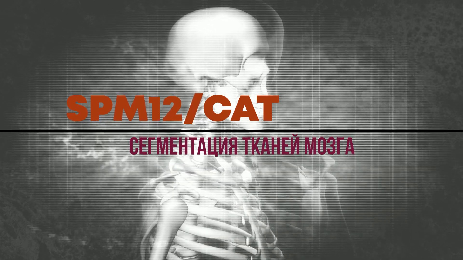 003. SPM12/CAT. Сегментация результатов МРТ-исследований.