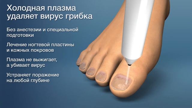 Холодная плазма в действии