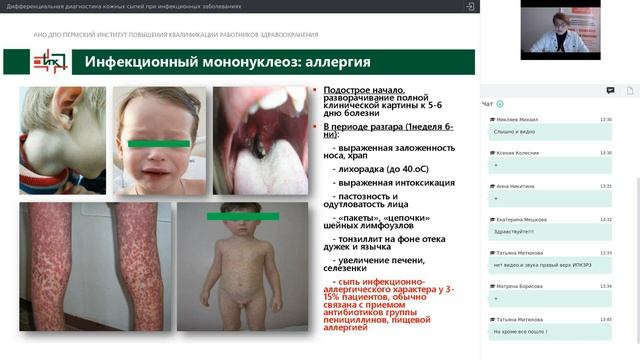 Дифференциальная диагностика кожных сыпей при инфекционных заболеваниях (Черанева О.В.).mp4
