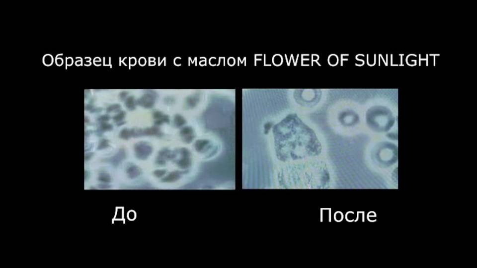 Гемотест крови до и после применения масла Flower Of Sunlight