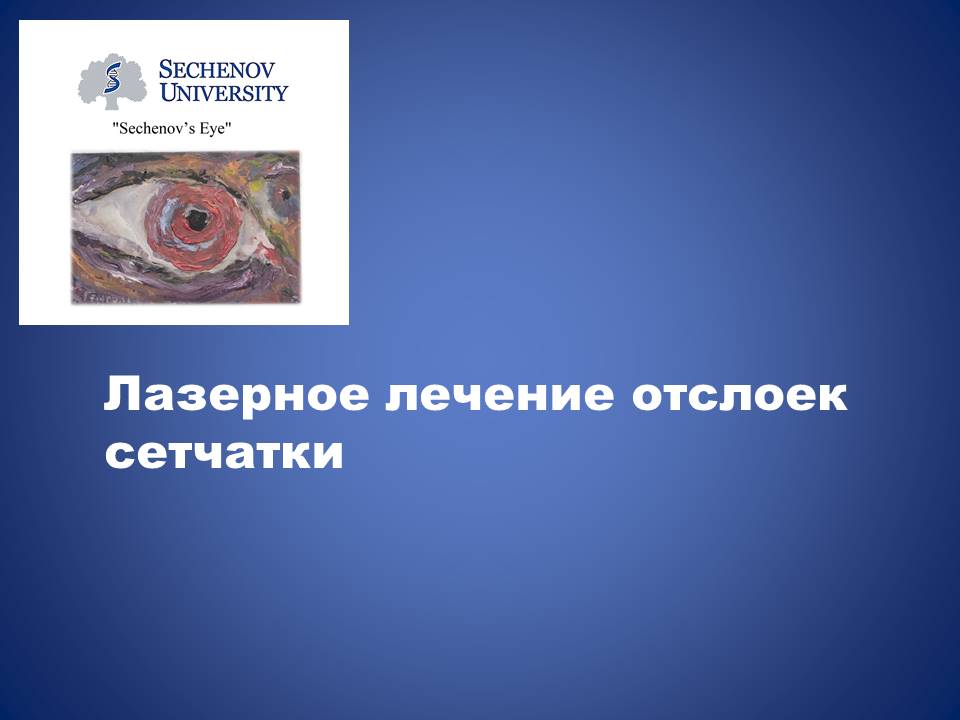 Лазерное лечение отслоек сетчатки