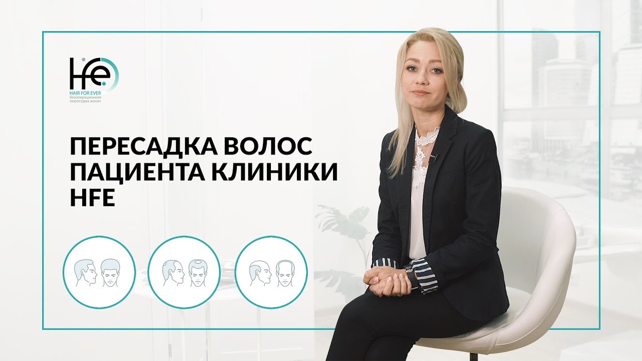 Пересадка волос после их потери. История пациента|HFE Clinic