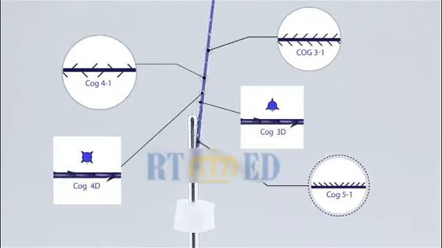 4d pdo thread lift korea feel tech molding cog