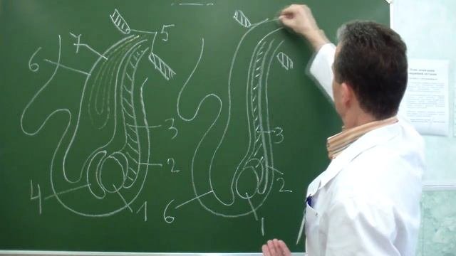 Схемы приобретенной, врожденной и скользящей паховых грыж