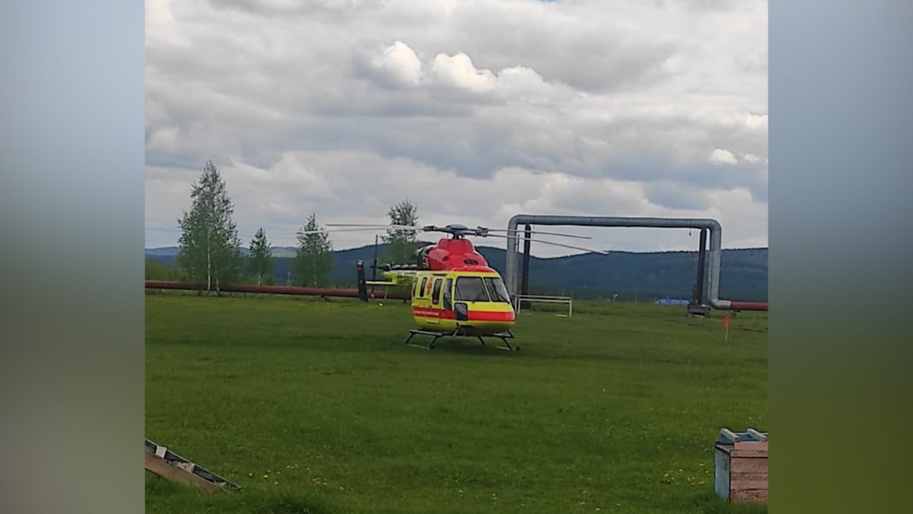Спасатели помогли в эвакуации пациента с ожогами в Челябинск