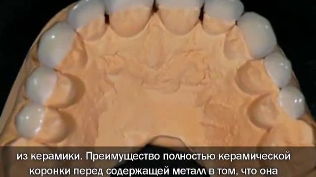 Пломбы-заплатки или старые коронки