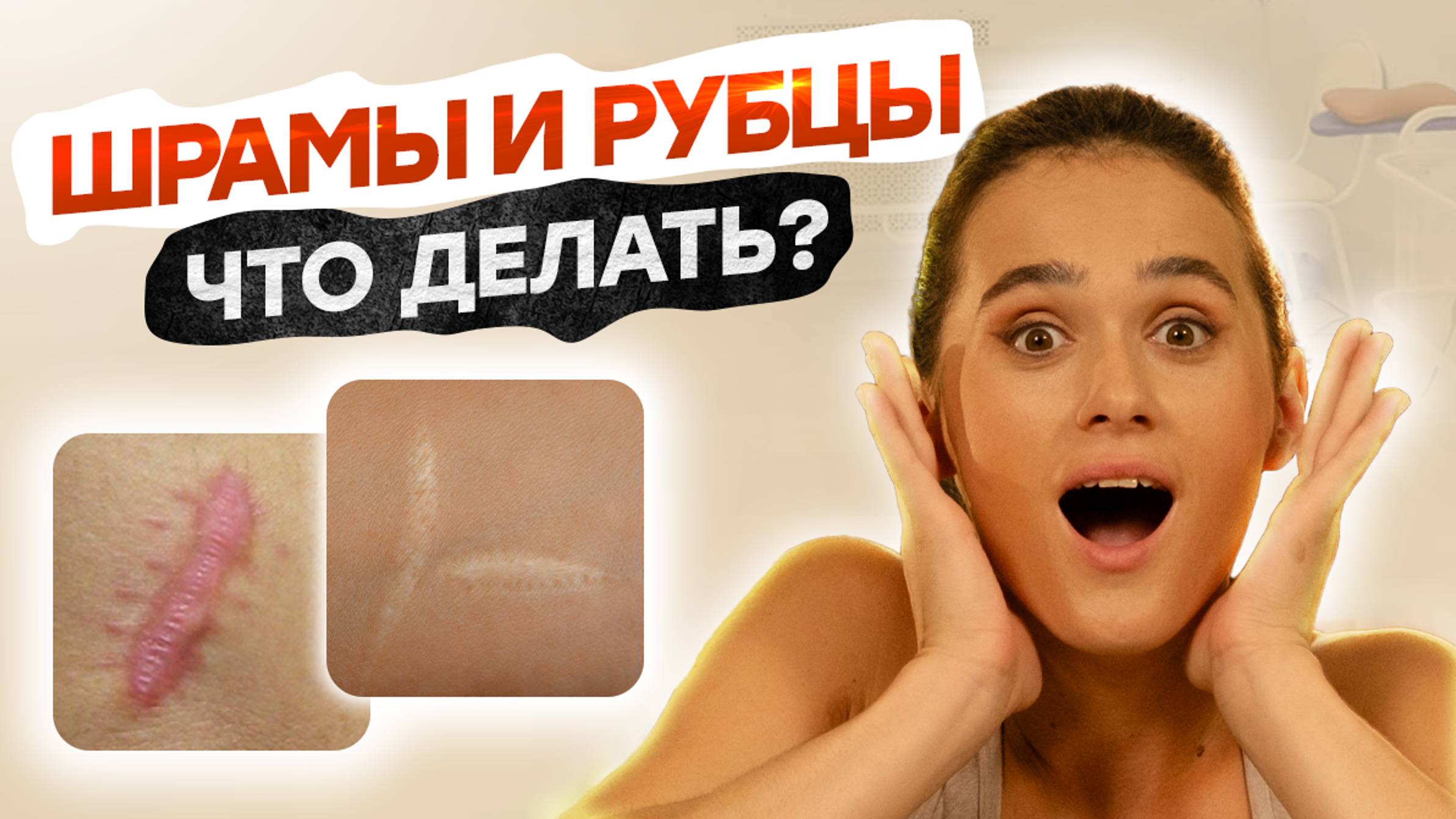 Что делать со ШРАМОМ У РЕБЕНКА? | Как сделать его НЕ ЗАМЕТНЫМ?