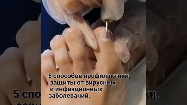 Зачистка онихолизиса Онлайн Курс "Заболевания ногтей и кожи"