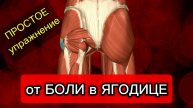 Боль в ЯГОДИЦЕ | Боль в ПОЯСНИЦЕ | Что делать?