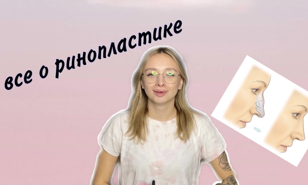РИНОПЛАСТИКА | СКОЛЬКО СТОИТ?? | СТОИТ ЛИ ДЕЛАТЬ???