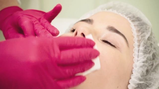 Neauvia коррекция губ препаратом Intense Lips. Работа тренера Neauvia Корчагиной Елены.