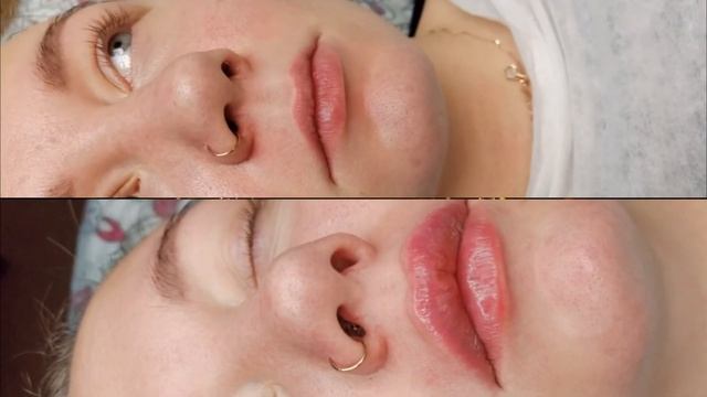 Архитектура губ. Косметолог Елена Шультц