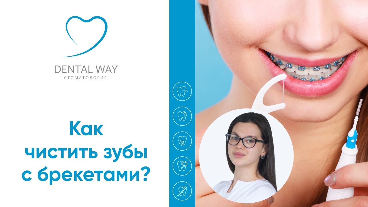 Как чистить зубы с брекетами